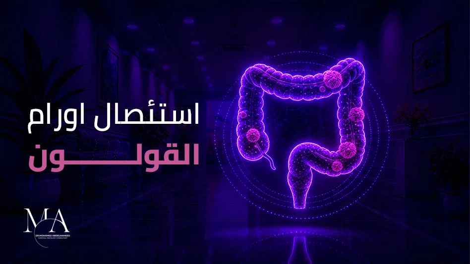 عملية استئصال سرطان القولون