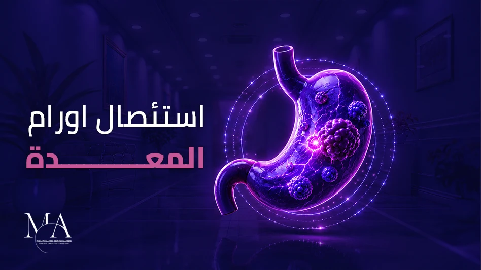 علاج سرطان المعدة
