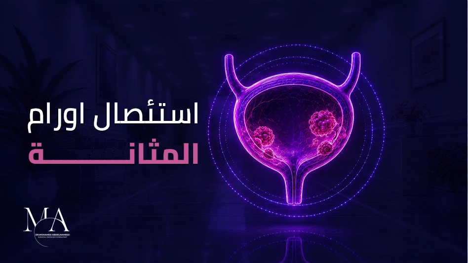 عملية استئصال ورم المثانة