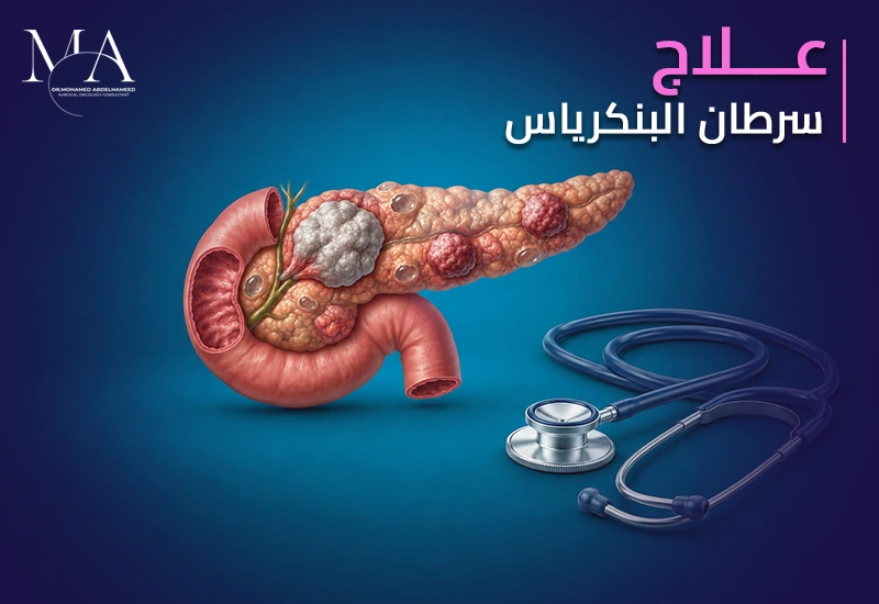 علاج سرطان البنكرياس