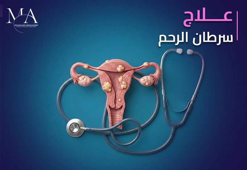 علاج سرطان الرحم : العلاج المناسب لكل حالة