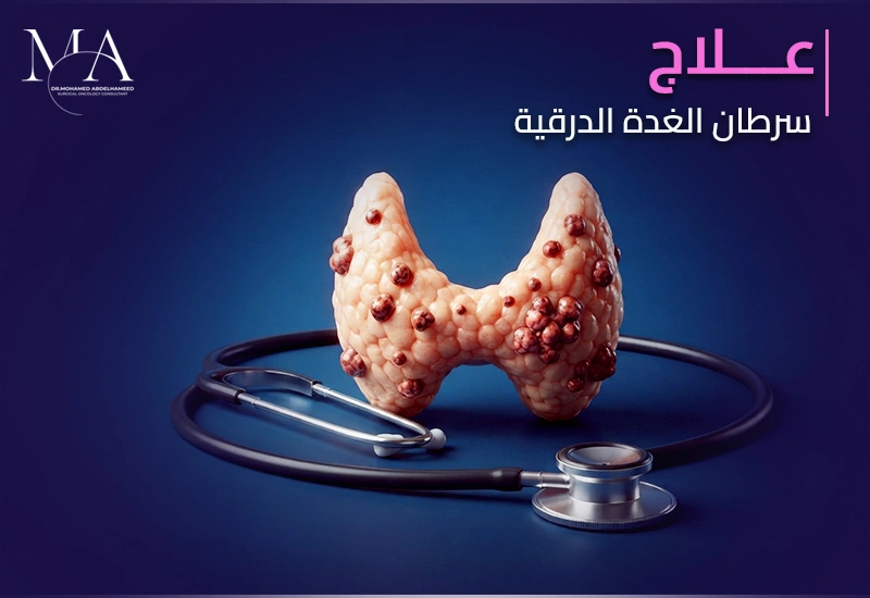 علاج سرطان الغدة الدرقية