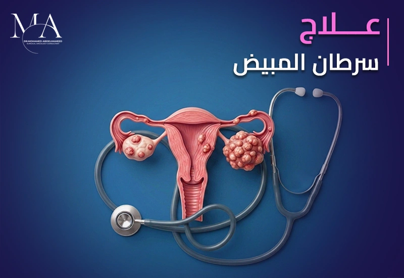 علاج سرطان المبيض طرق التشخيص والعلاج