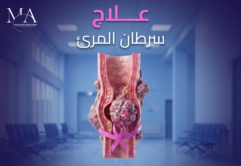سرطان المريء: الأسباب والأعراض وطرق العلاج