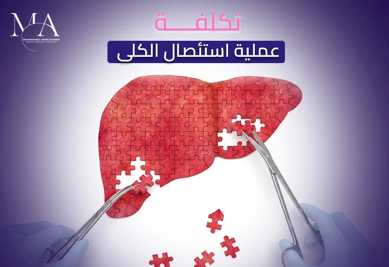تعرف على تكلفة عملية استئصال الكلى