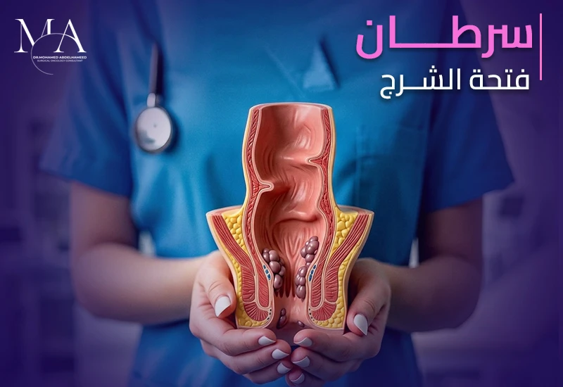 طرق علاج سرطان الشرج وكيفية تشخيصه
