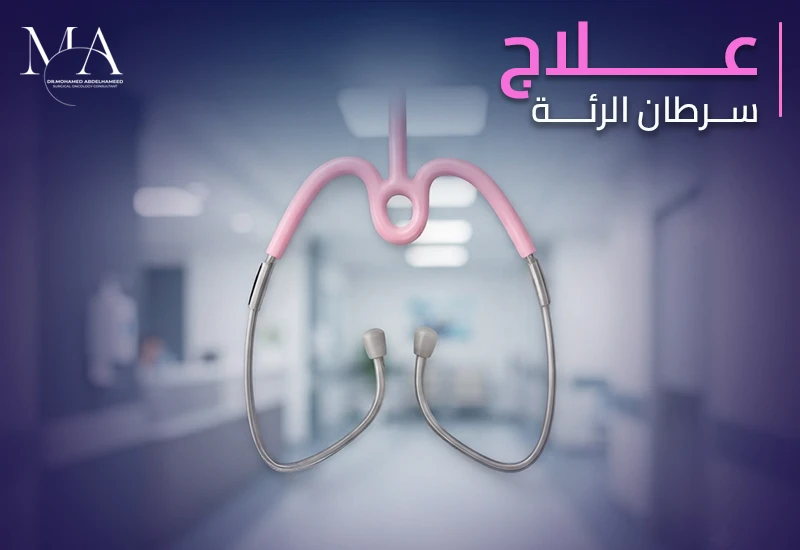 ما هو بروتوكول علاج سرطان الرئة وكيف يتم تحديده؟