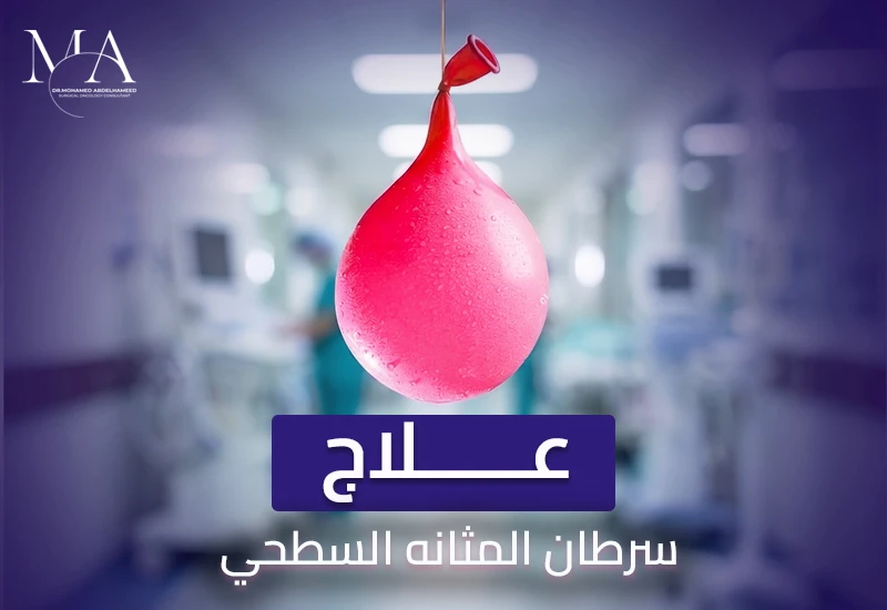 طرق علاج سرطان المثانة السطحي