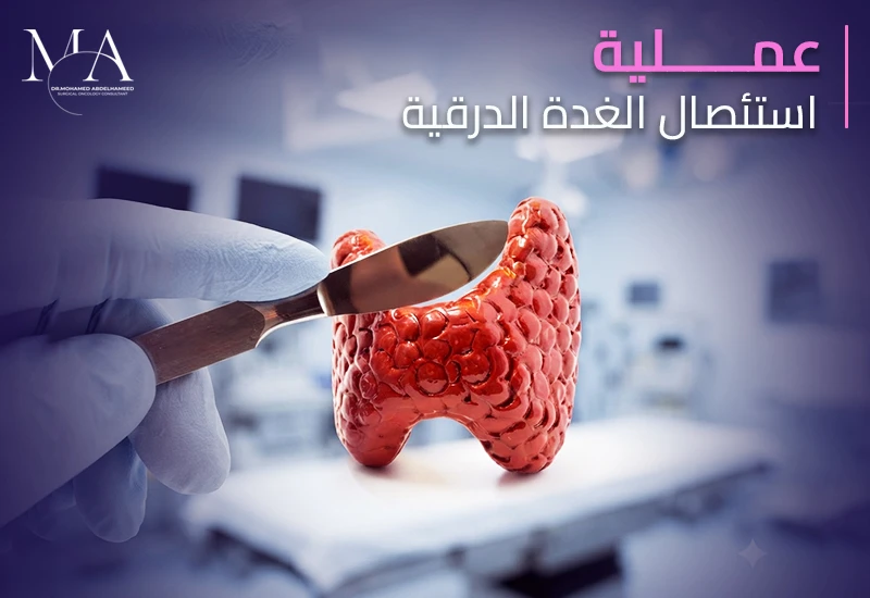 ما هي عملية استئصال الغدة الدرقية وكيف تتم؟