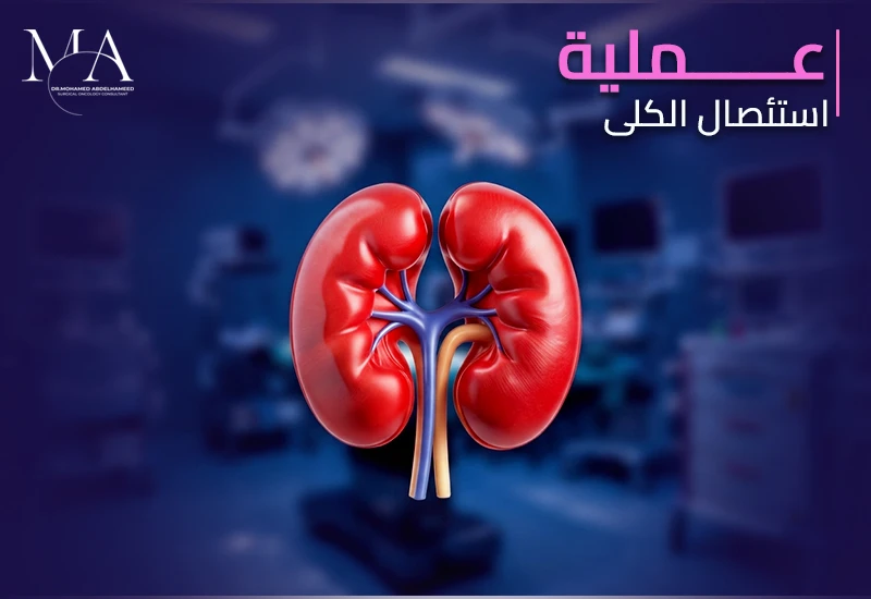 كيف تتم عملية استئصال الكلى؟