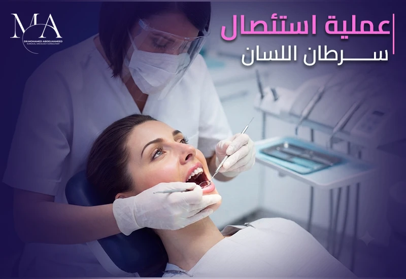 ما هي عملية استئصال سرطان اللسان ومتى تكون ضرورية؟
