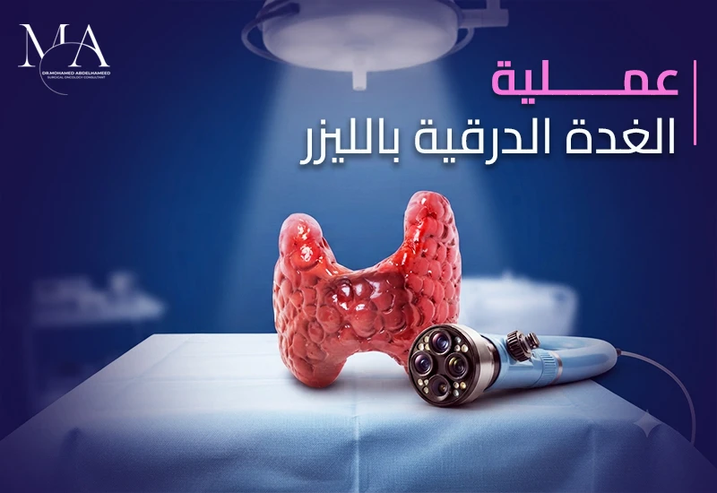 ما هي عملية الغدة الدرقية بالليزر وما هي الحالات المرشحة؟