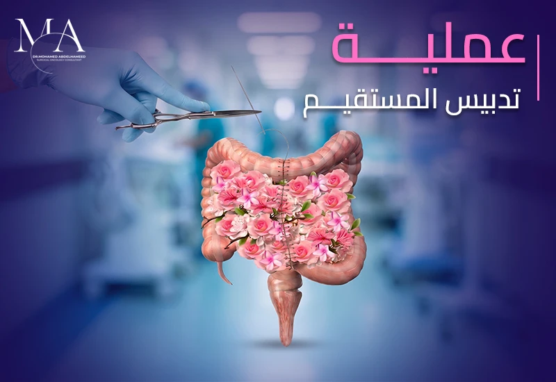 ما هي عملية تدبيس المستقيم وكيف يتم إجرائها؟