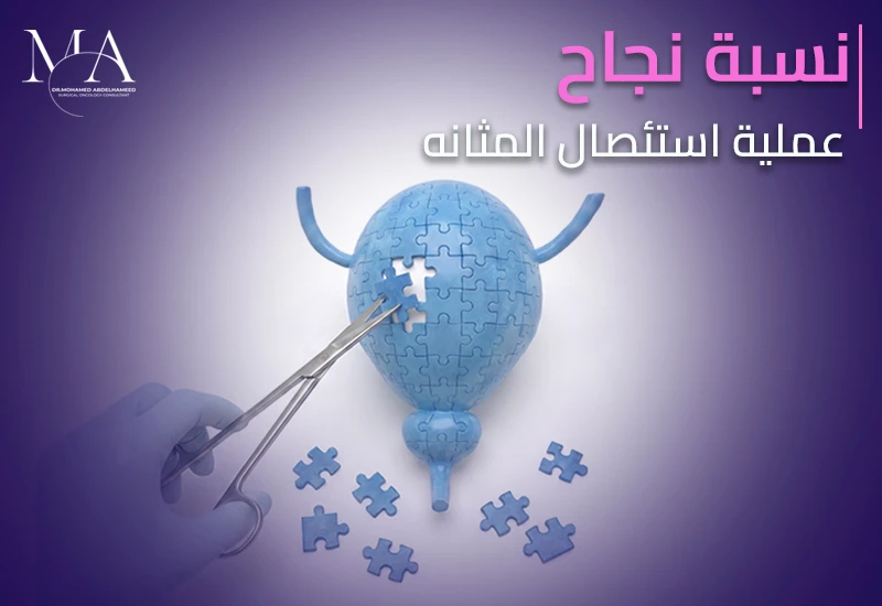 نسبه نجاح عمليه استئصال المثانه