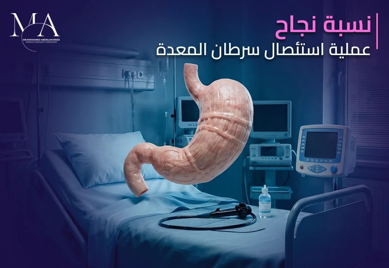 نسبة نجاح عملية استئصال سرطان المعدة – اتصل بنا الآن