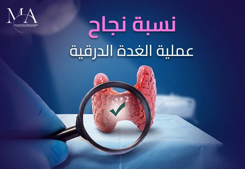 نسبة نجاح عملية الغدة الدرقية