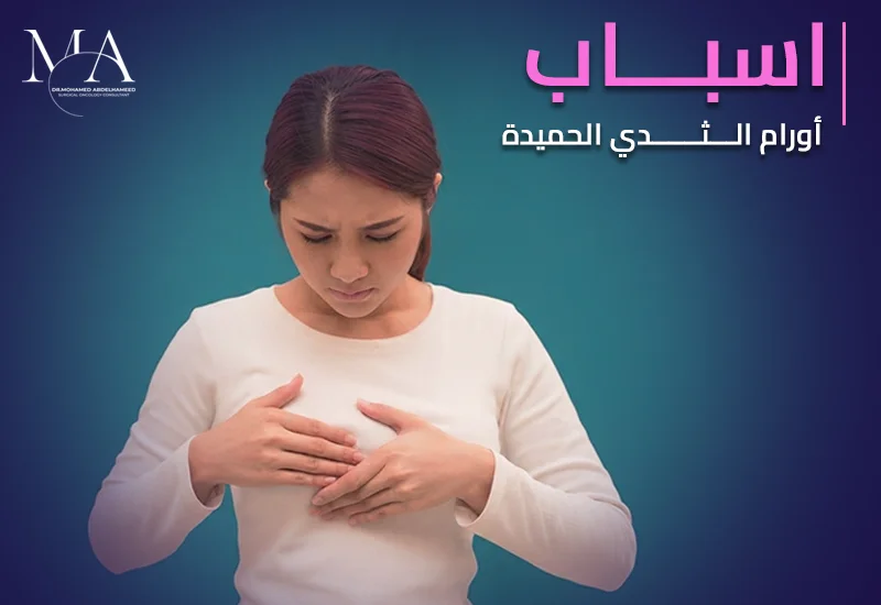 اسباب اورام الثدى الحميدة