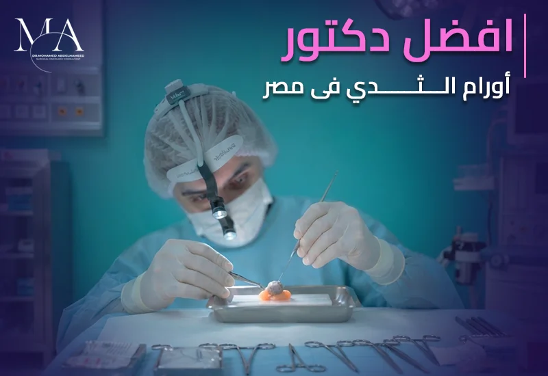 افضل دكتور اورام ثدى فى مصر