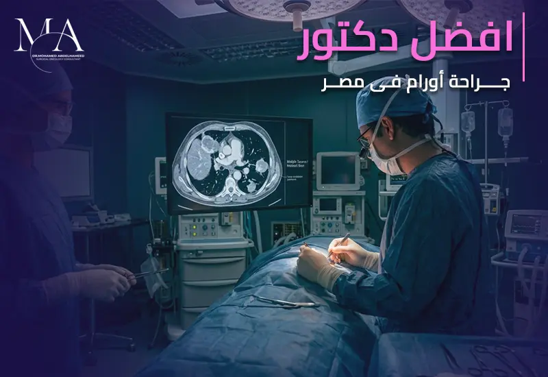 افضل دكتور جراحة اورام في مصر
