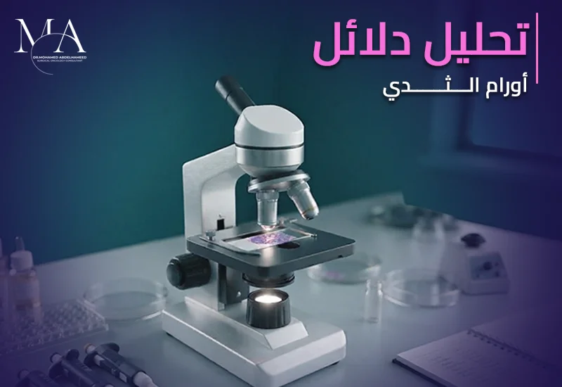 تحليل دلائل اورام الثدى